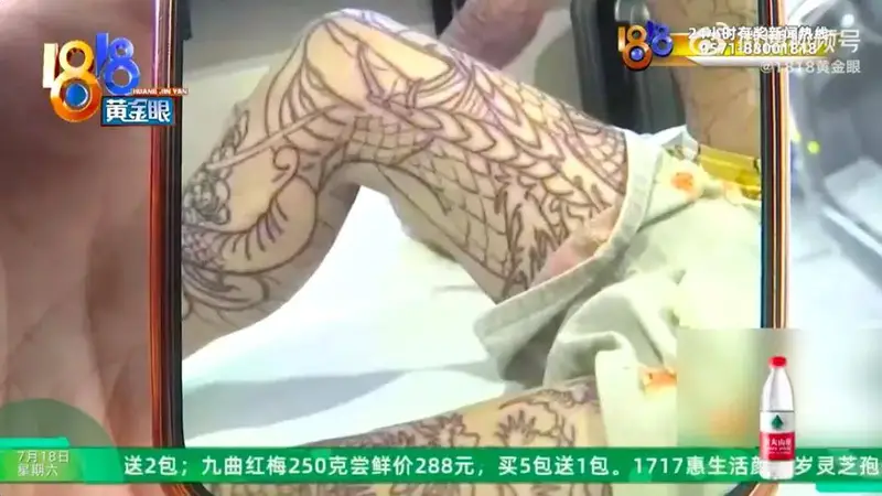 收1300元文身费，可能要赔12万洗掉——14岁男孩的“大花腿”，谁买单？