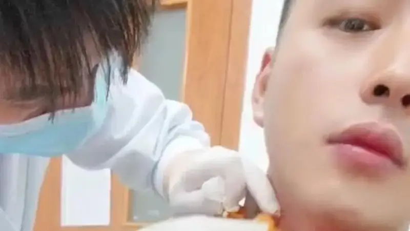 男子被蚊子叮咬脖子，抓挠后血流1小时不止，足足400毫升，当事人最新发声；接诊医生称“第一次遇到”，可能和刚健身完有关